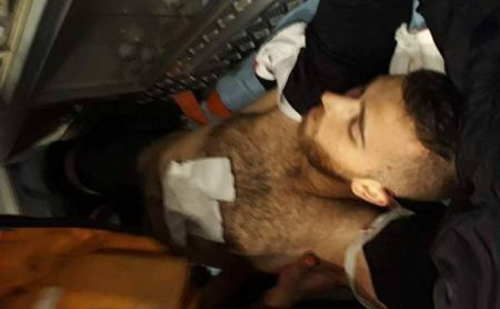 شهيد وعشرات الجرحى بمواجهات عنيفة مع الاحتلال شمال نابلس